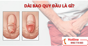 dài bao quy đầu