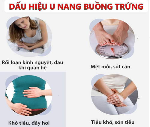 U nang buồng trứng