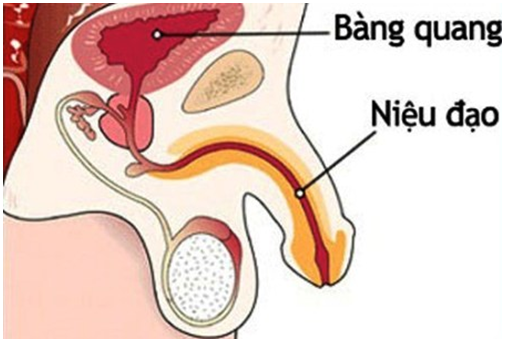 tiểu buốt ra mủ